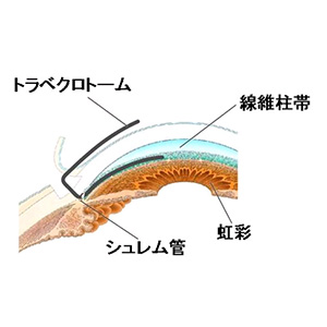 手術内容1