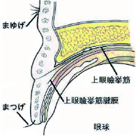 上眼瞼挙筋