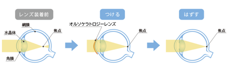 レンズ装着イメージ