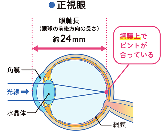 正視眼